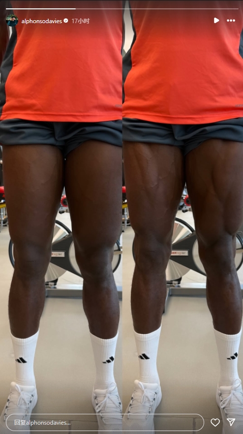 重伤归来！阿方索晒照自己腿部的变化，轻松练出肌肉